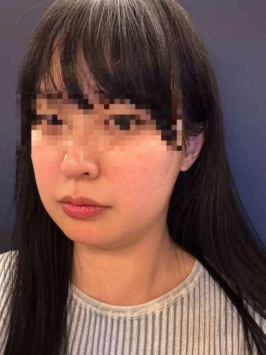 홍대신지윤피부관리 이미지