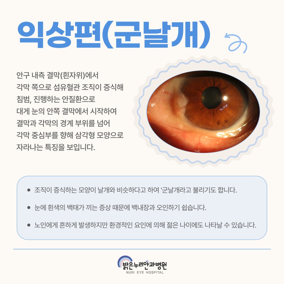 세종안과 이미지