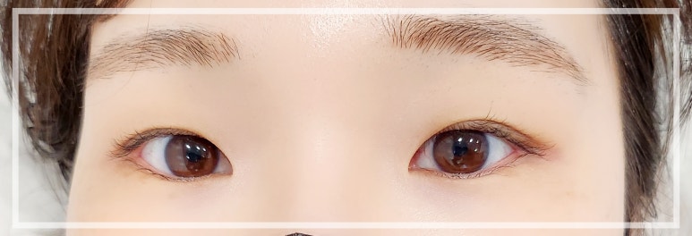 아이뻐라 이미지
