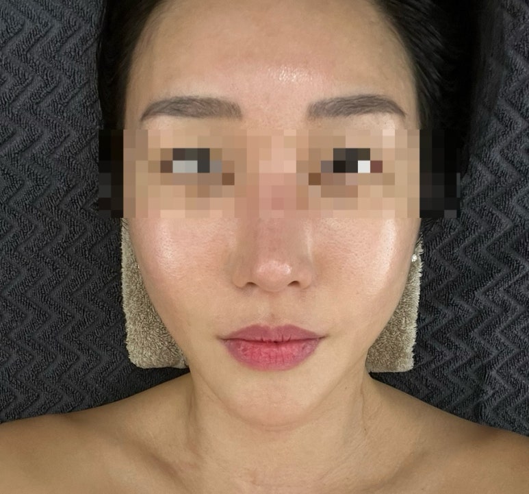 싱잉볼 에스테틱 이미지
