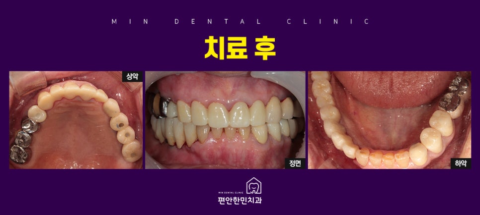 편안한민치과 이미지
