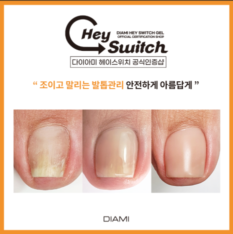 어썸네일 이미지