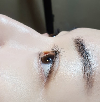수인래쉬 이미지