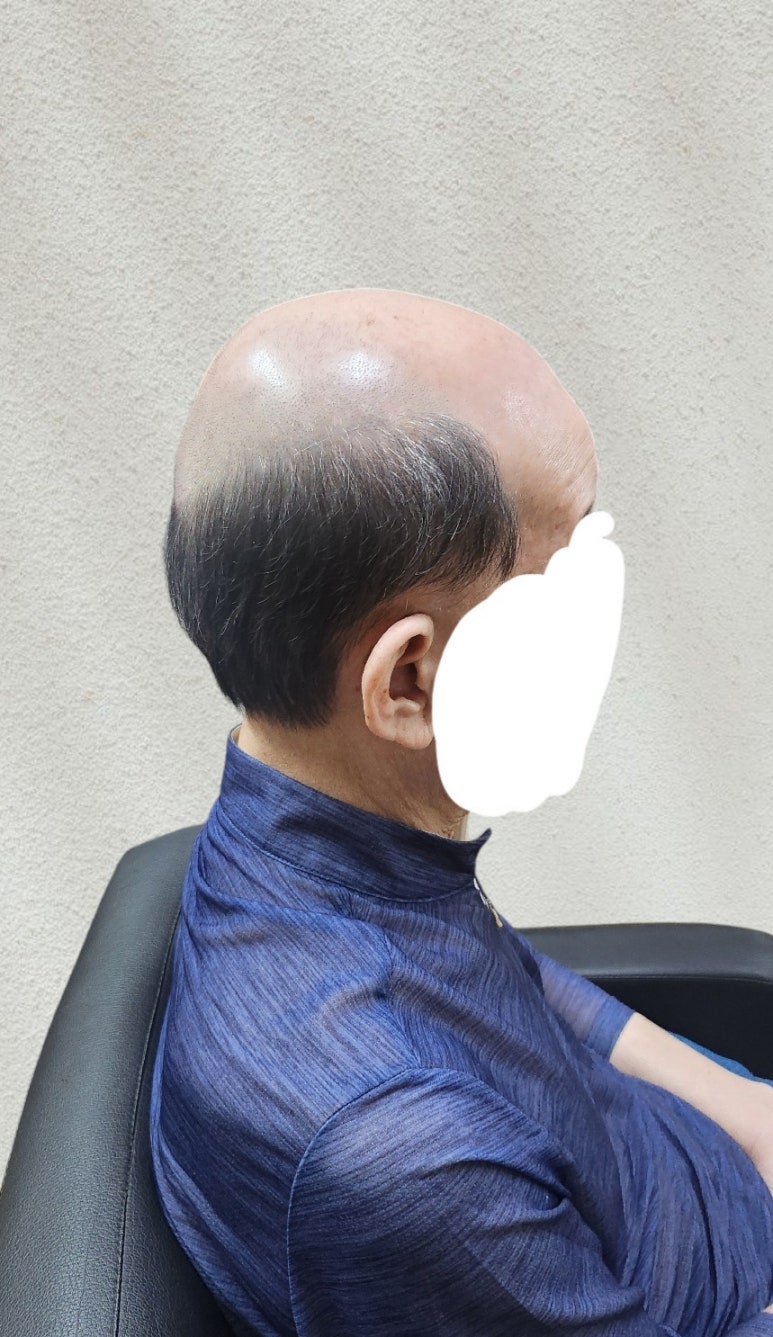 민재가발 이미지