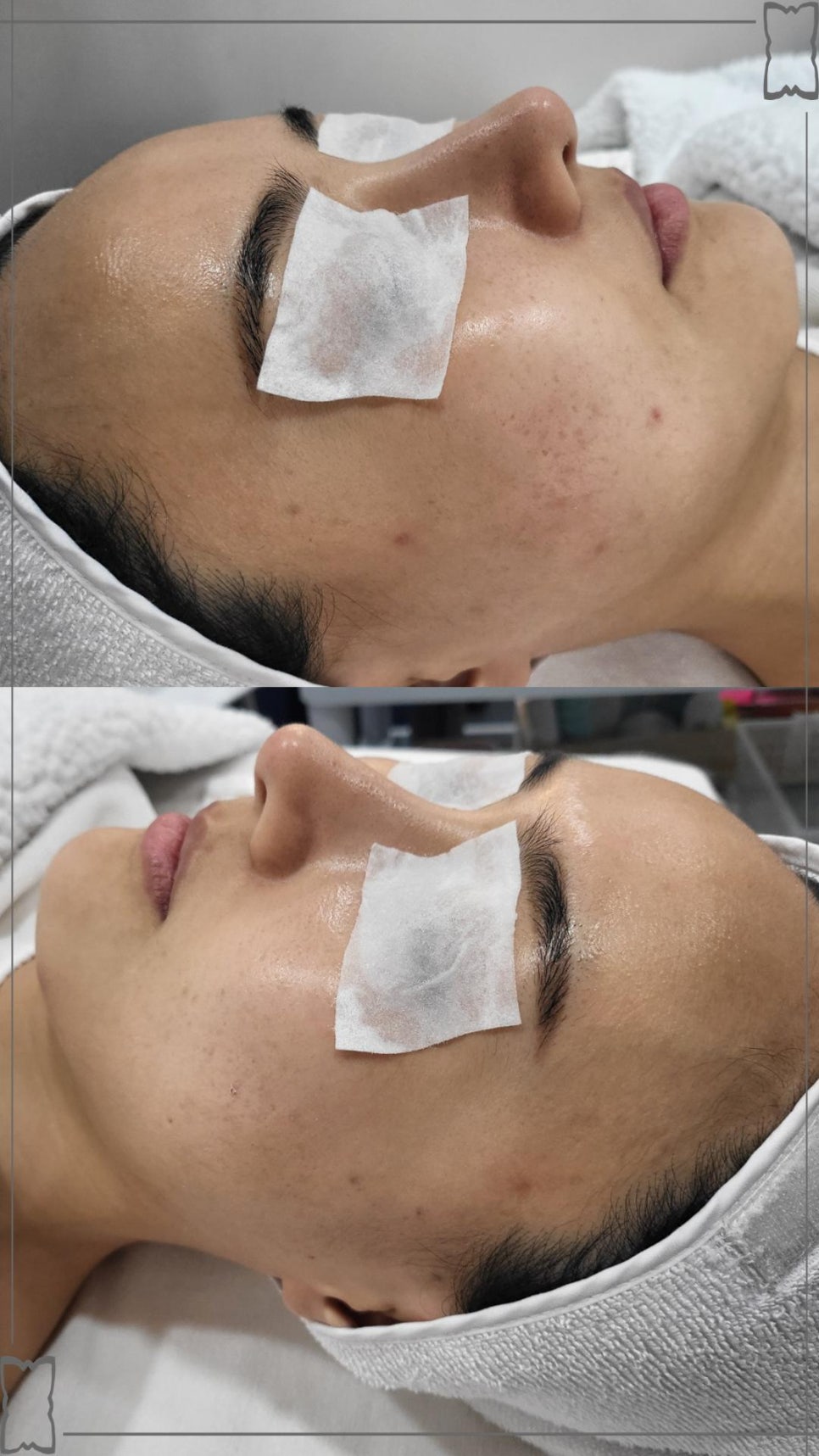 테라톡스 이미지