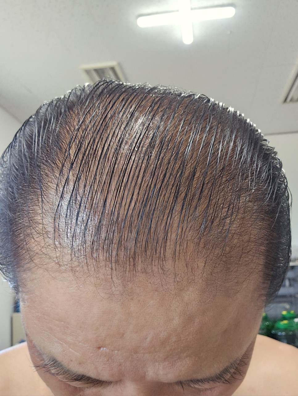 머리나라 이미지