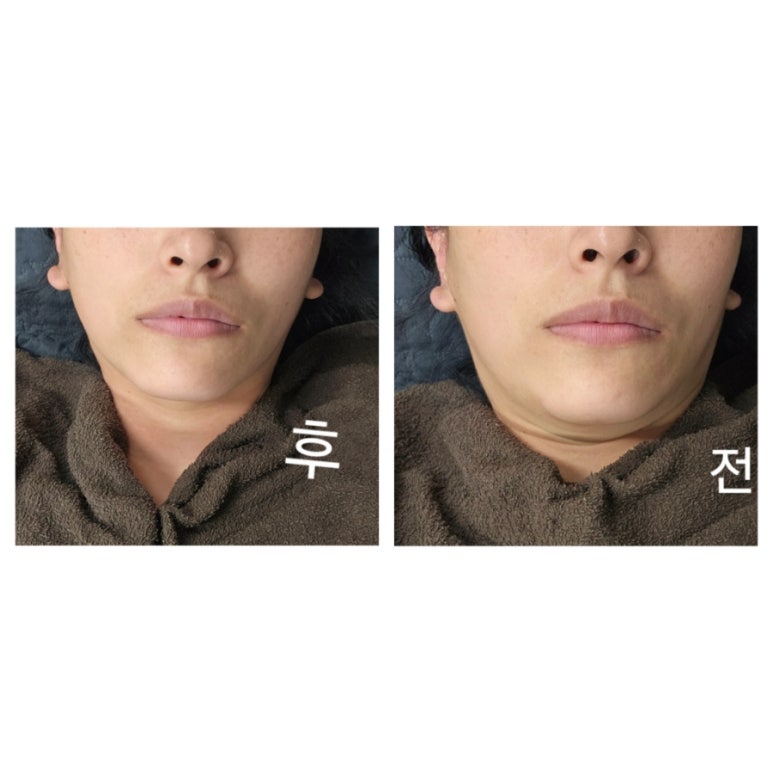 오늘은밝은피부 이미지