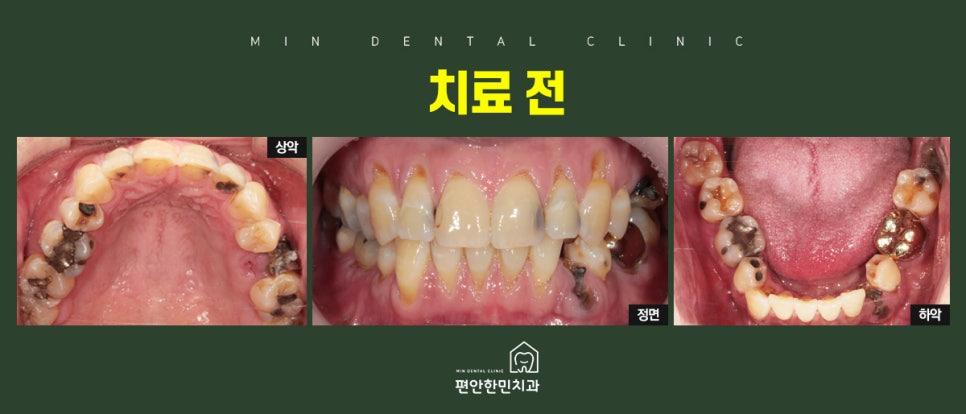 편안한민치과 이미지