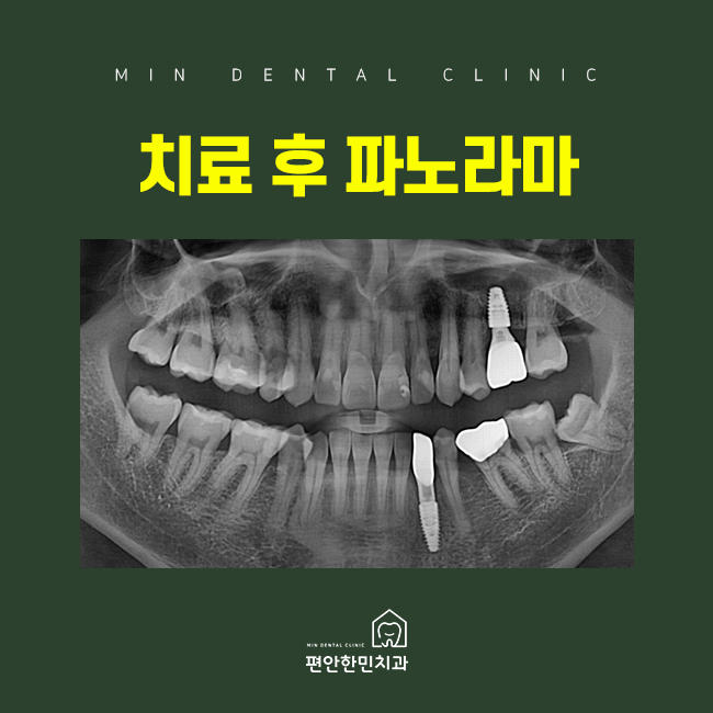 편안한민치과 이미지