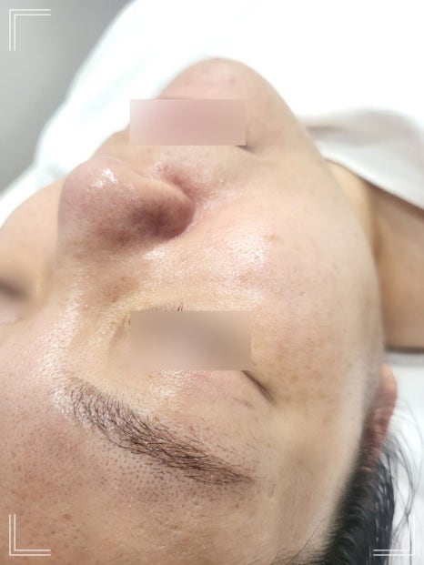 테라톡스 이미지
