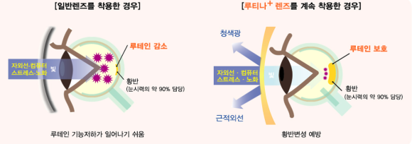 루아이즈 이미지