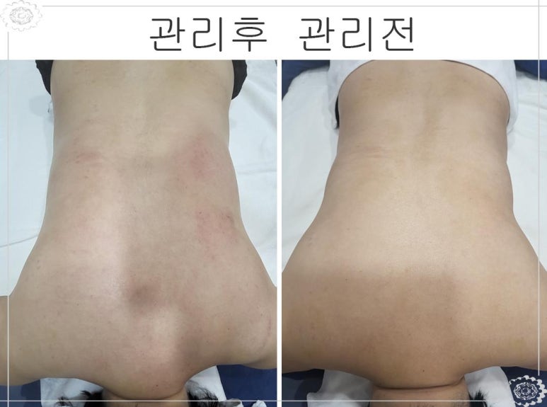 에스테틱인샵 이미지