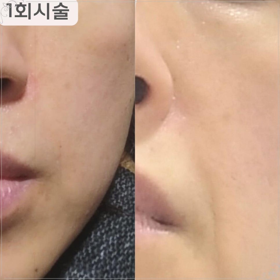 테라톡스 이미지