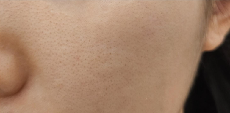 타이팅 메디케어 스킨앤바디 이미지