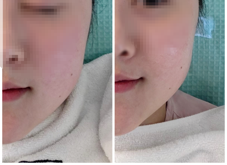 타임동안뷰티센터타임그루답터포맨 이미지