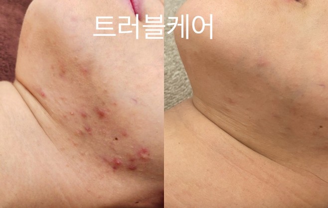 천안체형관리 이미지