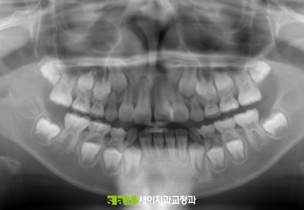 새이치과교정과치과의원 이미지