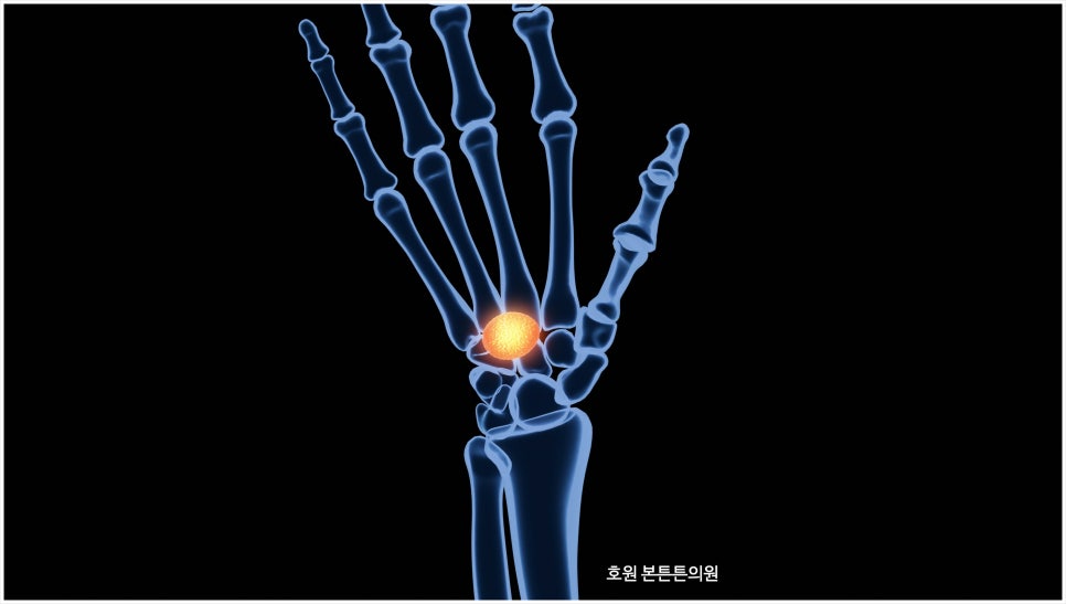 호원본튼튼의원 이미지