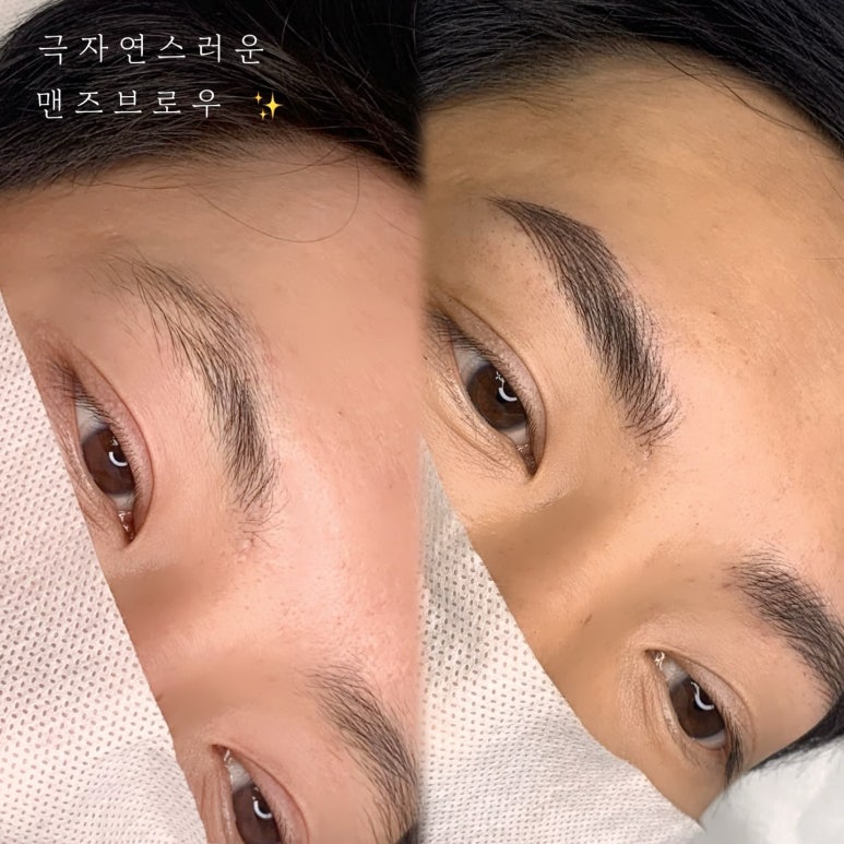 다움스킨 이미지