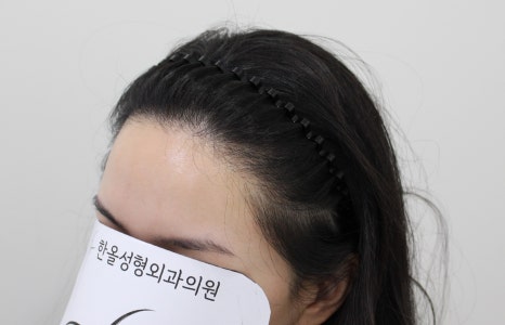 더헤어라인성형외과의원 이미지