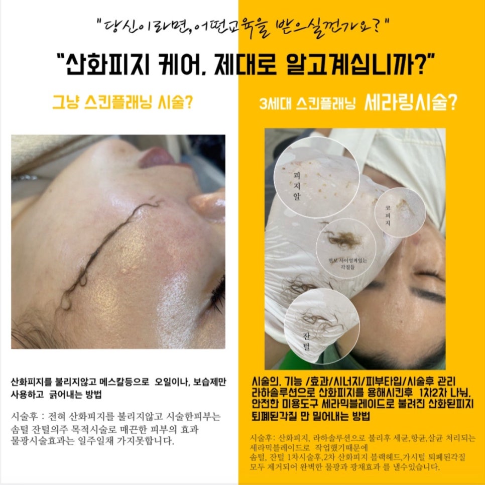 뷰티세라 이미지