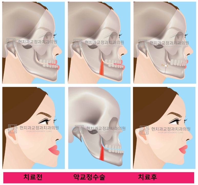 현치과교정과치과의원 이미지