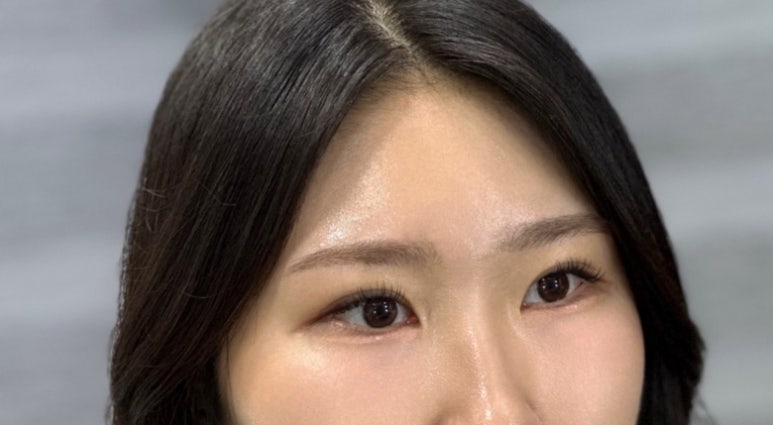 유라임 이미지