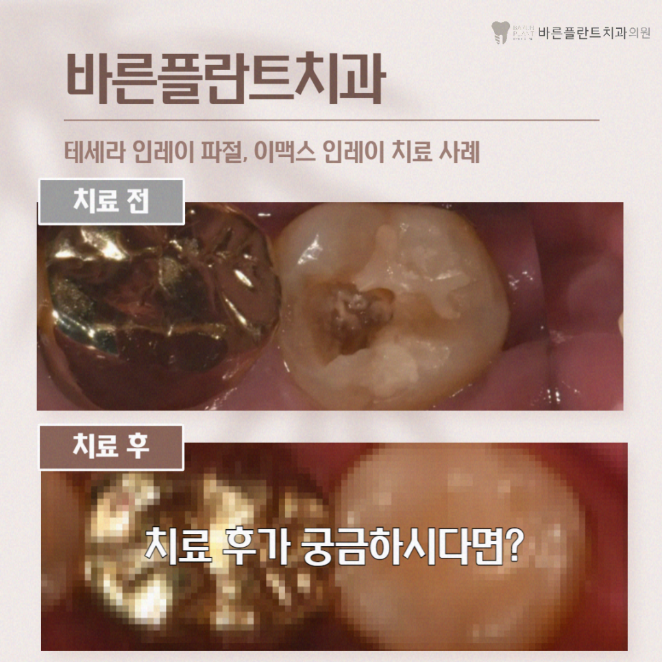 서울바른정치과의원 이미지