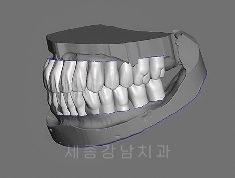 강남세종치과의원 이미지