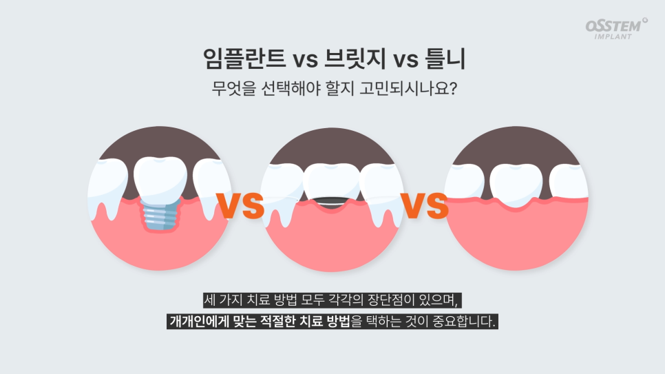 더원브릿지 이미지