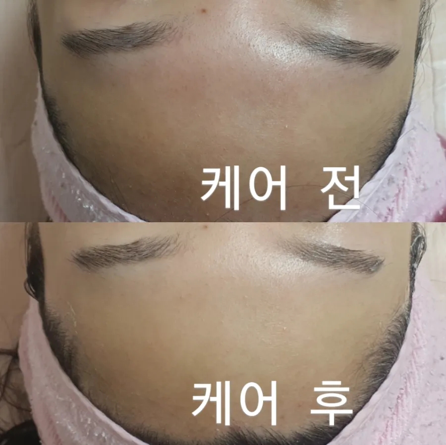 에스케어 이미지