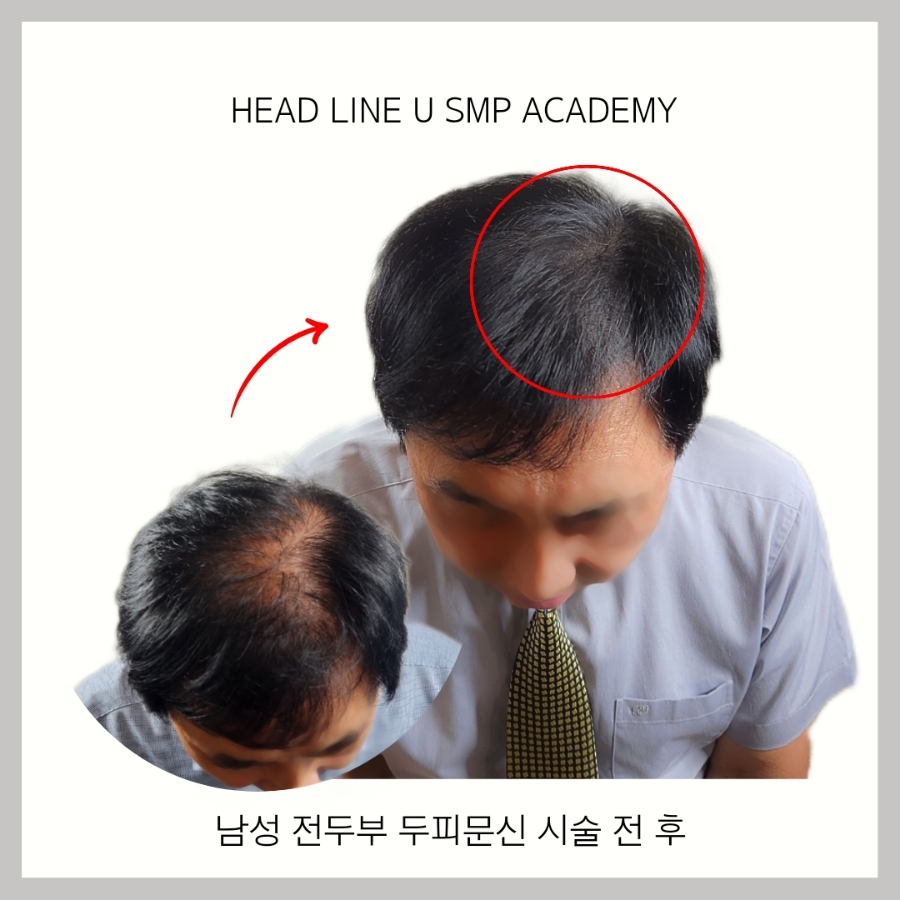 헤드라인유 이미지