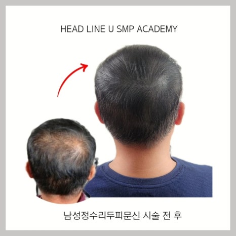 헤드라인유 이미지