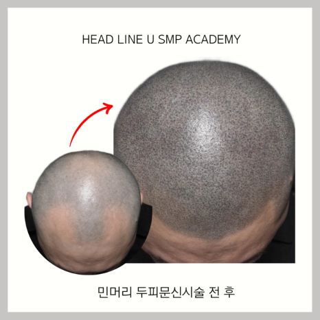 헤드라인유 이미지