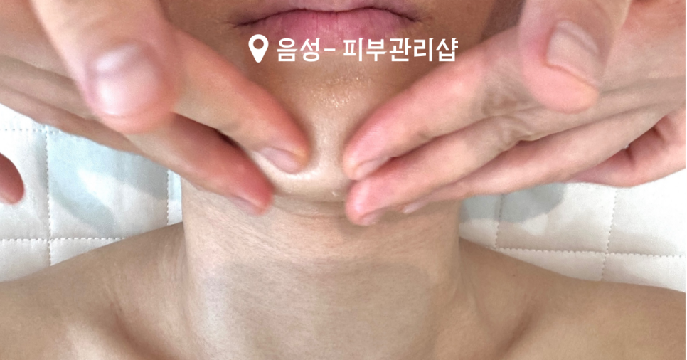 다온스킨 이미지