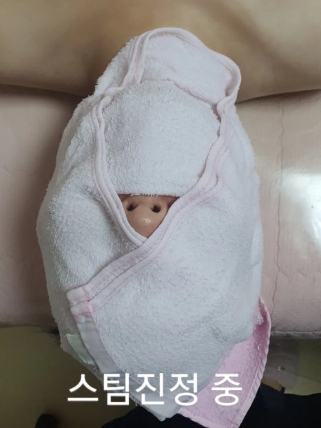 에스케어 이미지