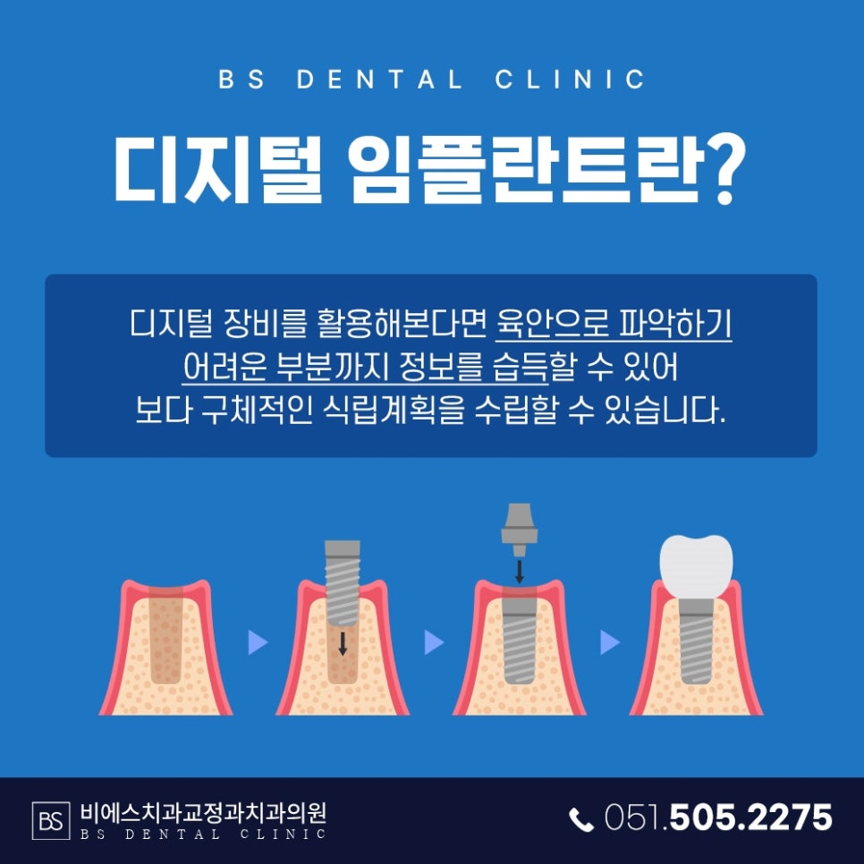 비에스브릿지 이미지