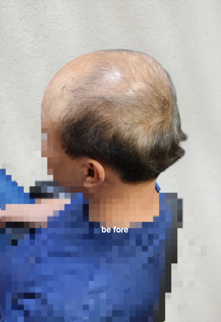 민재가발 이미지