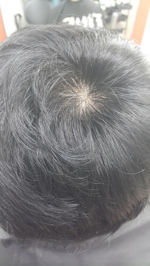플러스모발센터 이미지
