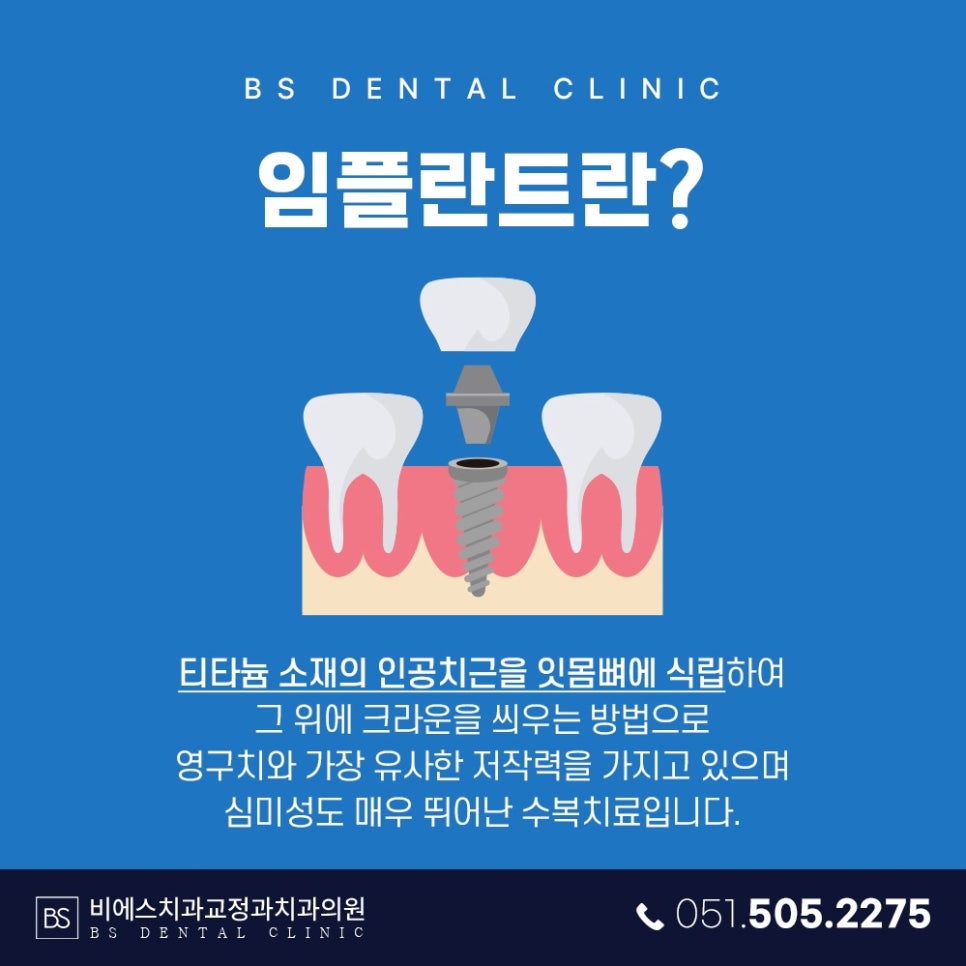 비에스브릿지 이미지