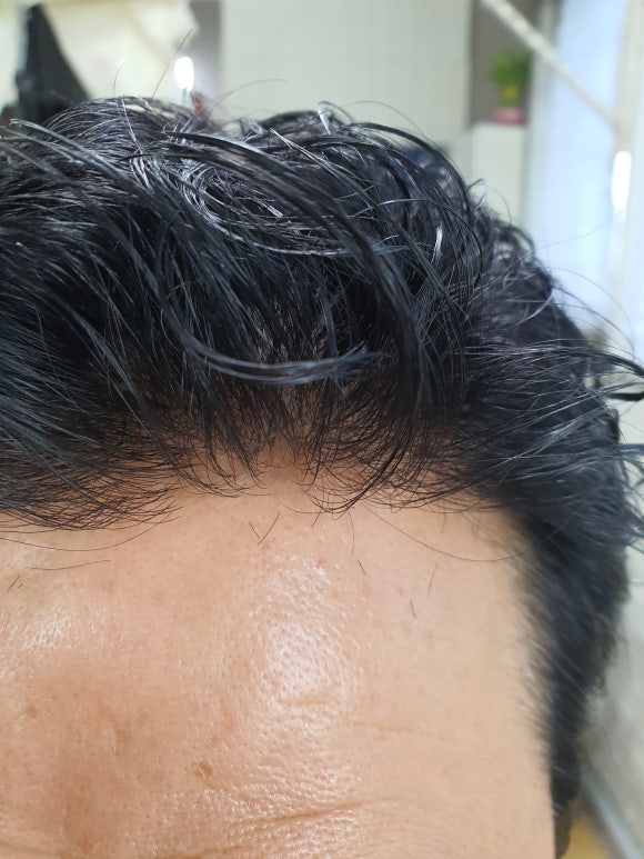 플러스모발센터 이미지