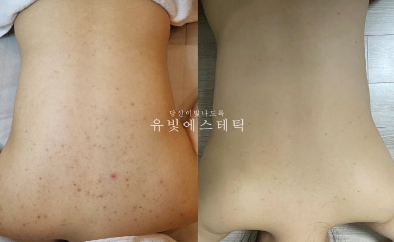 유빛 이미지