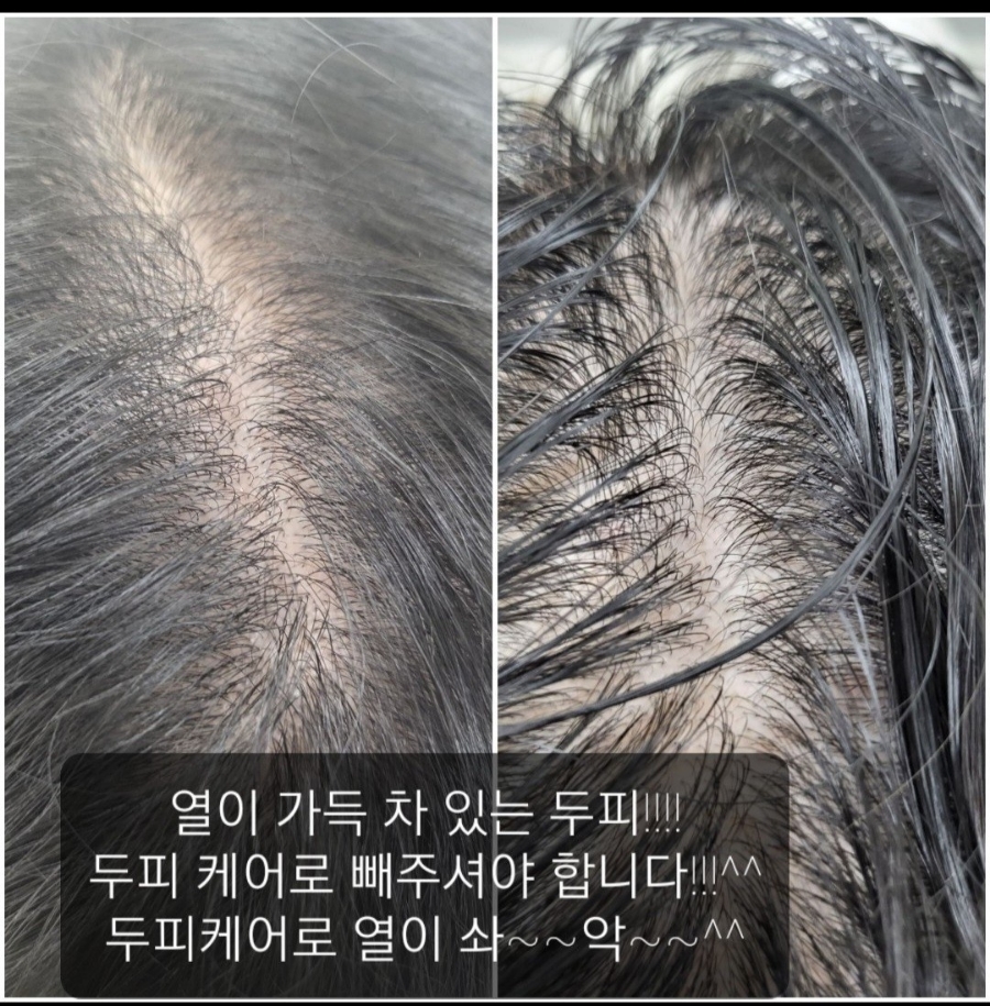 큐사랑 이미지