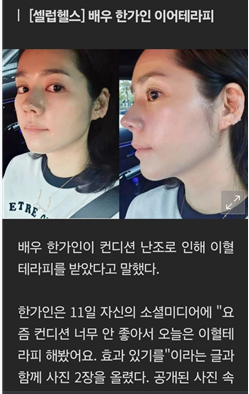 주얼리테라피 이미지