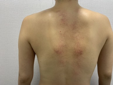 렌에너지 이미지