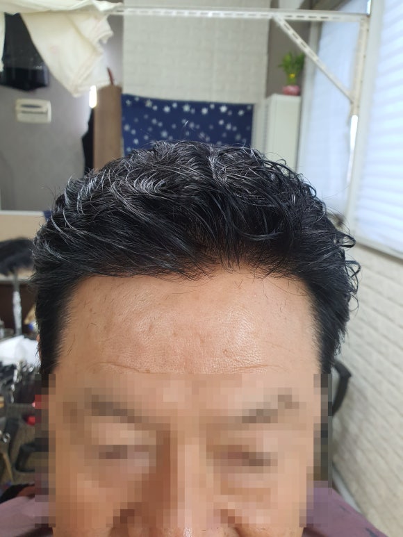 플러스모발센터 이미지