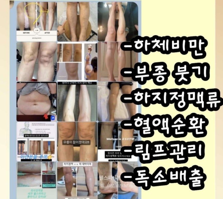 응암건강생활 이미지