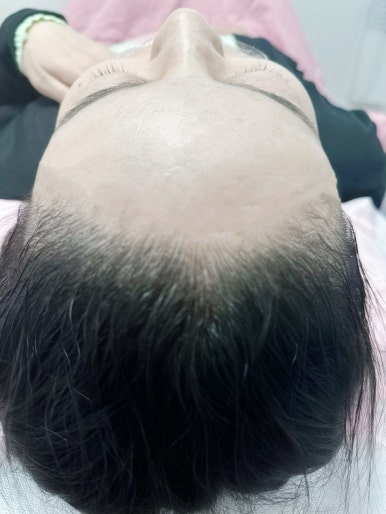 희야 헤어 이미지