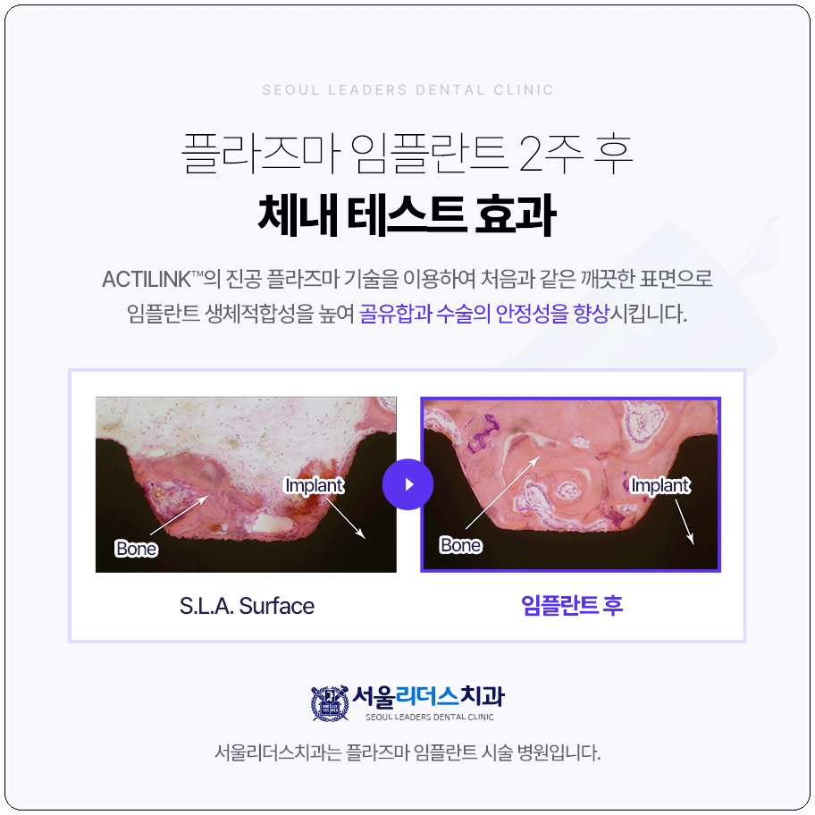 링크모션 이미지