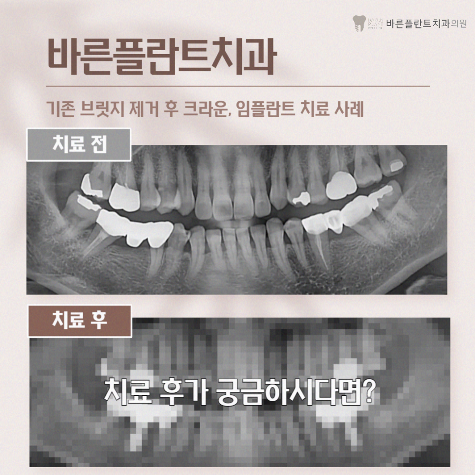 서울바른정치과의원 이미지